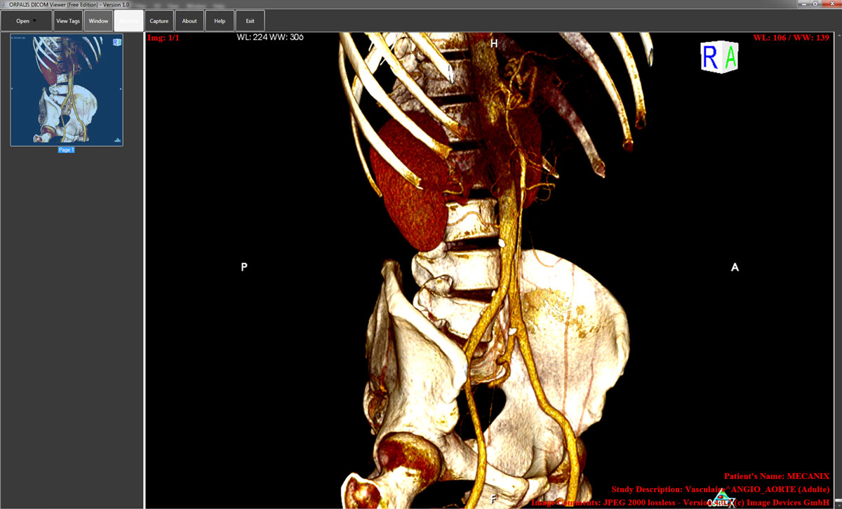 free dicom 3d viewer