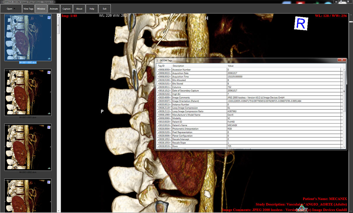 ORPALIS DICOM Viewer Free Preview 2